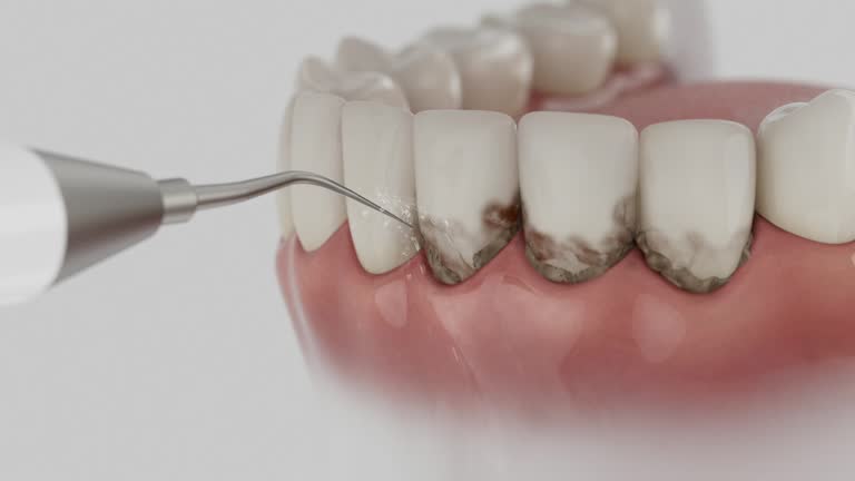 Reliable Emergency Dentist contractor in Wilder, VT by Smile Center Dentistry